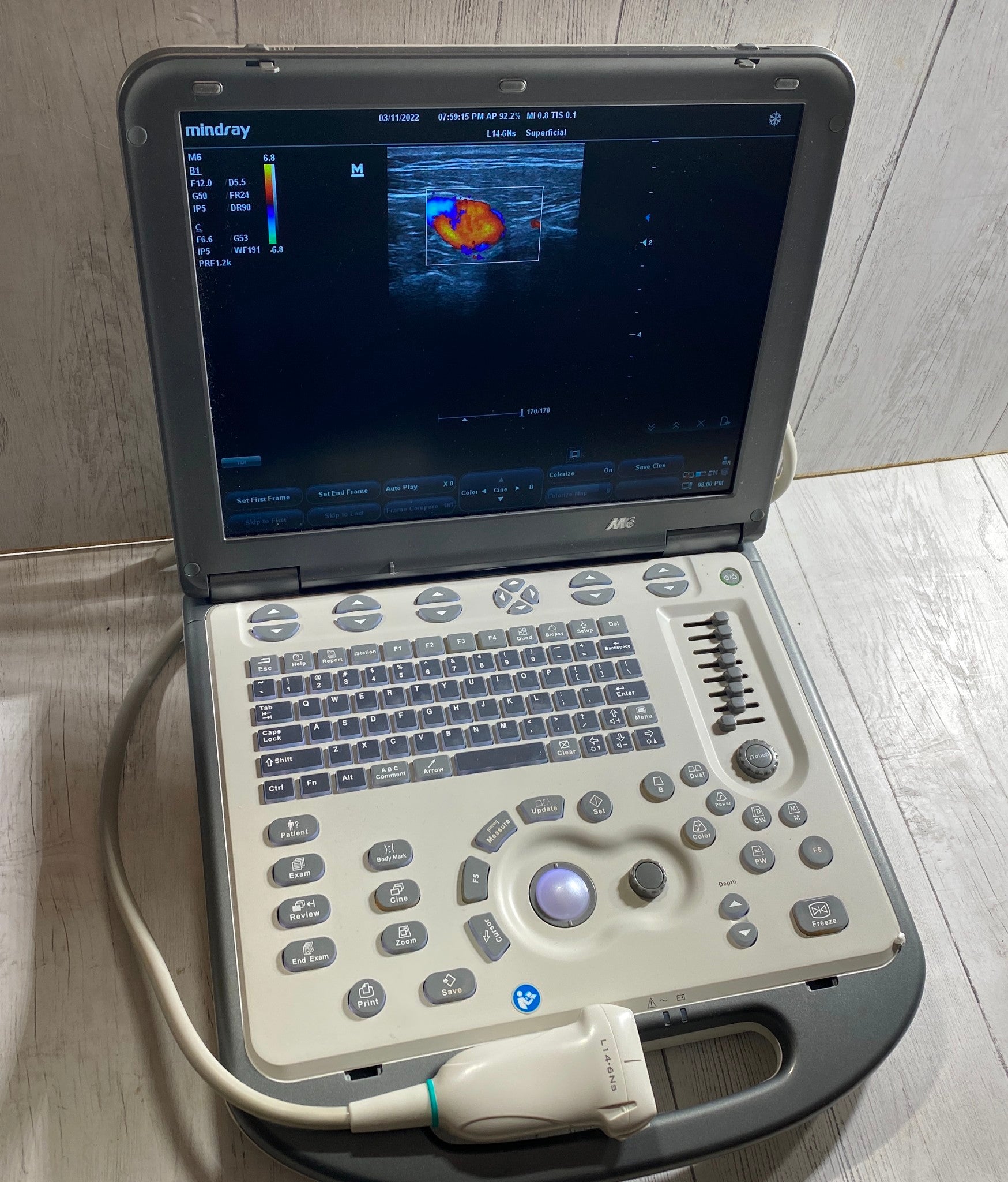 Mindray M6 Portable Ultraspund with one linear array probe L14-6NS 2018 DIAGNOSTIC ULTRASOUND MACHINES FOR SALE