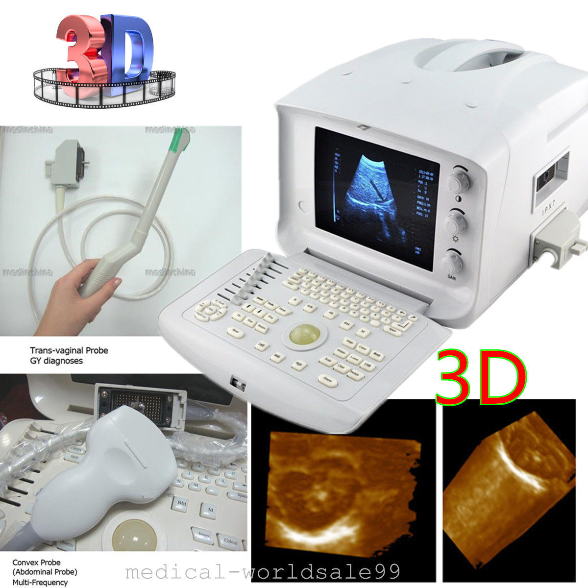 Full Digital Ultrasound Scanner/Machine Convex/Transvaginal 2 Probe USB Port 3D 190891466129 DIAGNOSTIC ULTRASOUND MACHINES FOR SALE