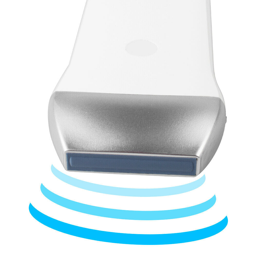 Portable Wireless WIFI Ultrasound Scanner Linear Array Probe 7.5Mhz 80 Elements DIAGNOSTIC ULTRASOUND MACHINES FOR SALE