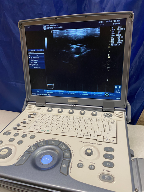 GE LOGIQ E Portable Ultrasound & phased array cardiac probe 6S-RS-Refurbished DIAGNOSTIC ULTRASOUND MACHINES FOR SALE