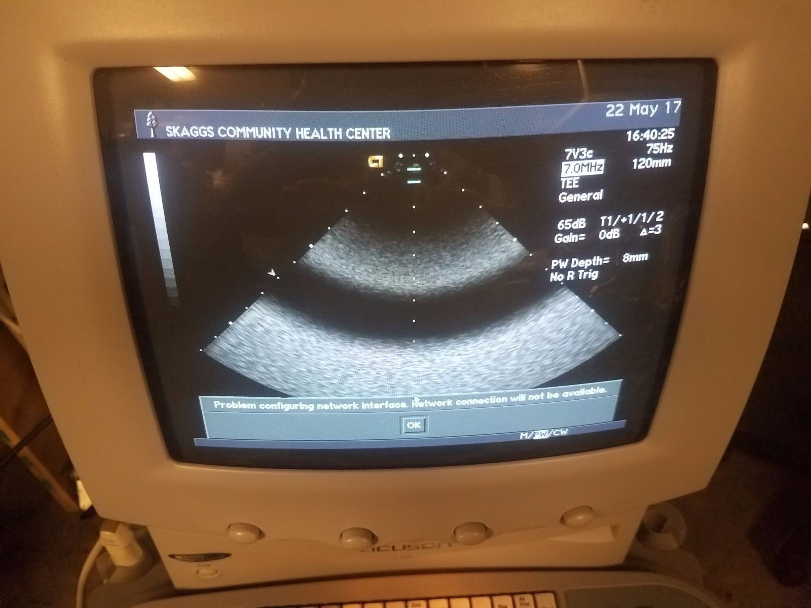 Seimens - Acuson Sequoia C256 Ultrasound System with 7V3c Probe DIAGNOSTIC ULTRASOUND MACHINES FOR SALE