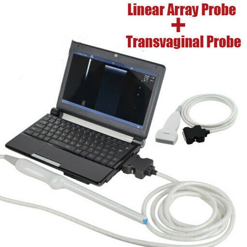 Pro Digital Laptop Ultrasound Machine Linear Array Probe + Transvaginal Probe DIAGNOSTIC ULTRASOUND MACHINES FOR SALE