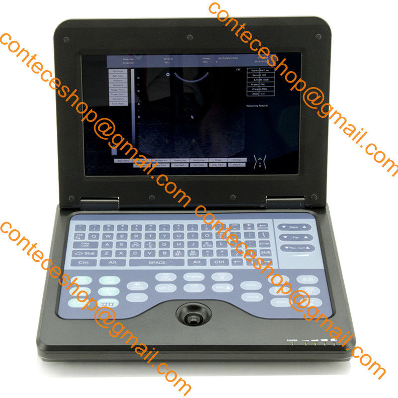 Portable Laptop Machine Digital Ultrasound Scanner, probe, human/vet, USA Fedex DIAGNOSTIC ULTRASOUND MACHINES FOR SALE