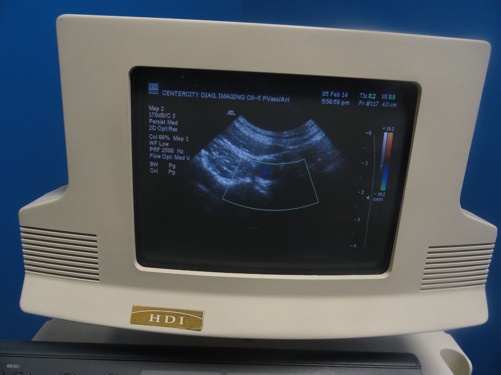 ATL C8-5 14R Micro-Convex 8.0-5.0 MHz Ultrasound Probe (6306) DIAGNOSTIC ULTRASOUND MACHINES FOR SALE