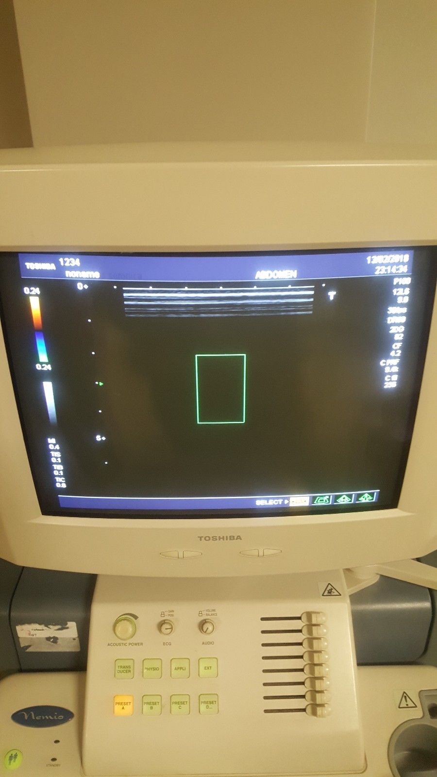 Toshiba Nemio 35 SSA-550A Diagnostic Ultrasound System DIAGNOSTIC ULTRASOUND MACHINES FOR SALE