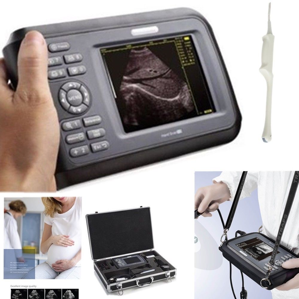Portable Digital Ultrasound machine Scanner system +6.5 Mhz transvaginal Probe DIAGNOSTIC ULTRASOUND MACHINES FOR SALE