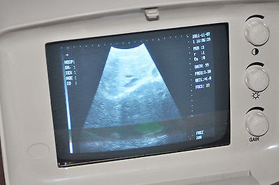 Portable ultrasound bladder scanner system Convex Transvaginal probe 3D Software DIAGNOSTIC ULTRASOUND MACHINES FOR SALE