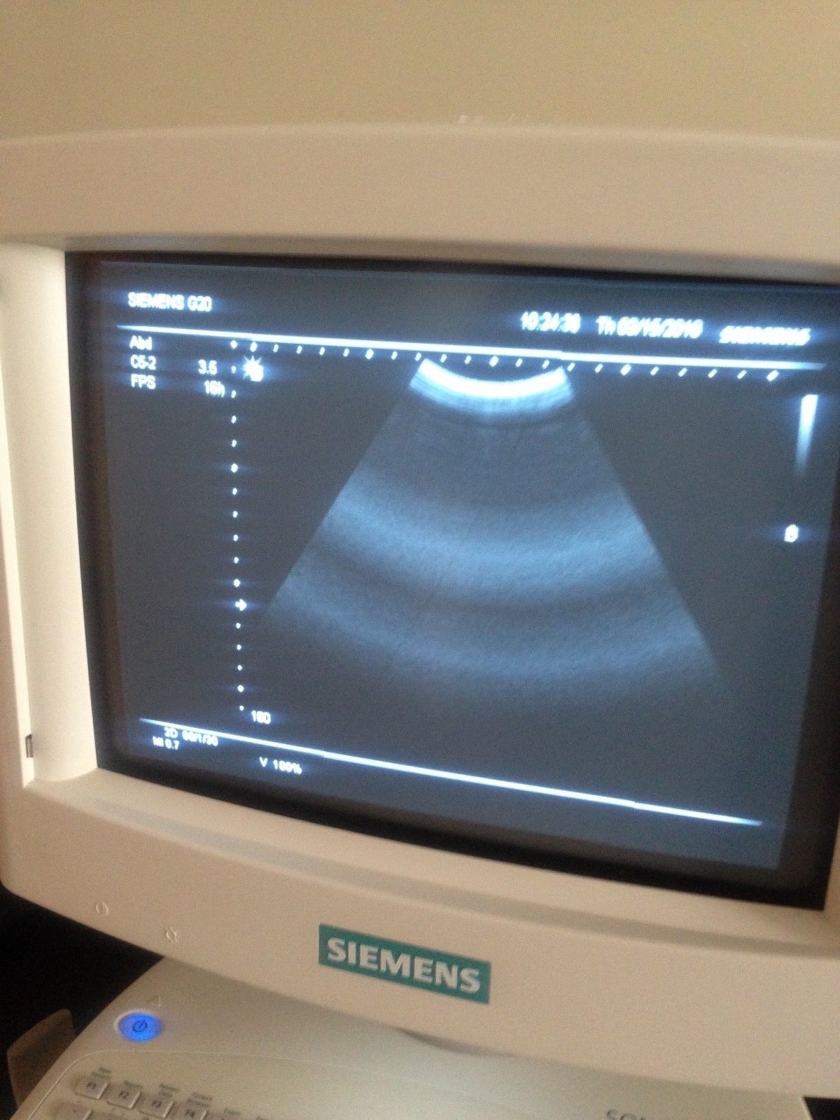 Siemens Sonoline G20 Ultrasound C5-2 Probe & Printer OB-GYN, Urology DIAGNOSTIC ULTRASOUND MACHINES FOR SALE