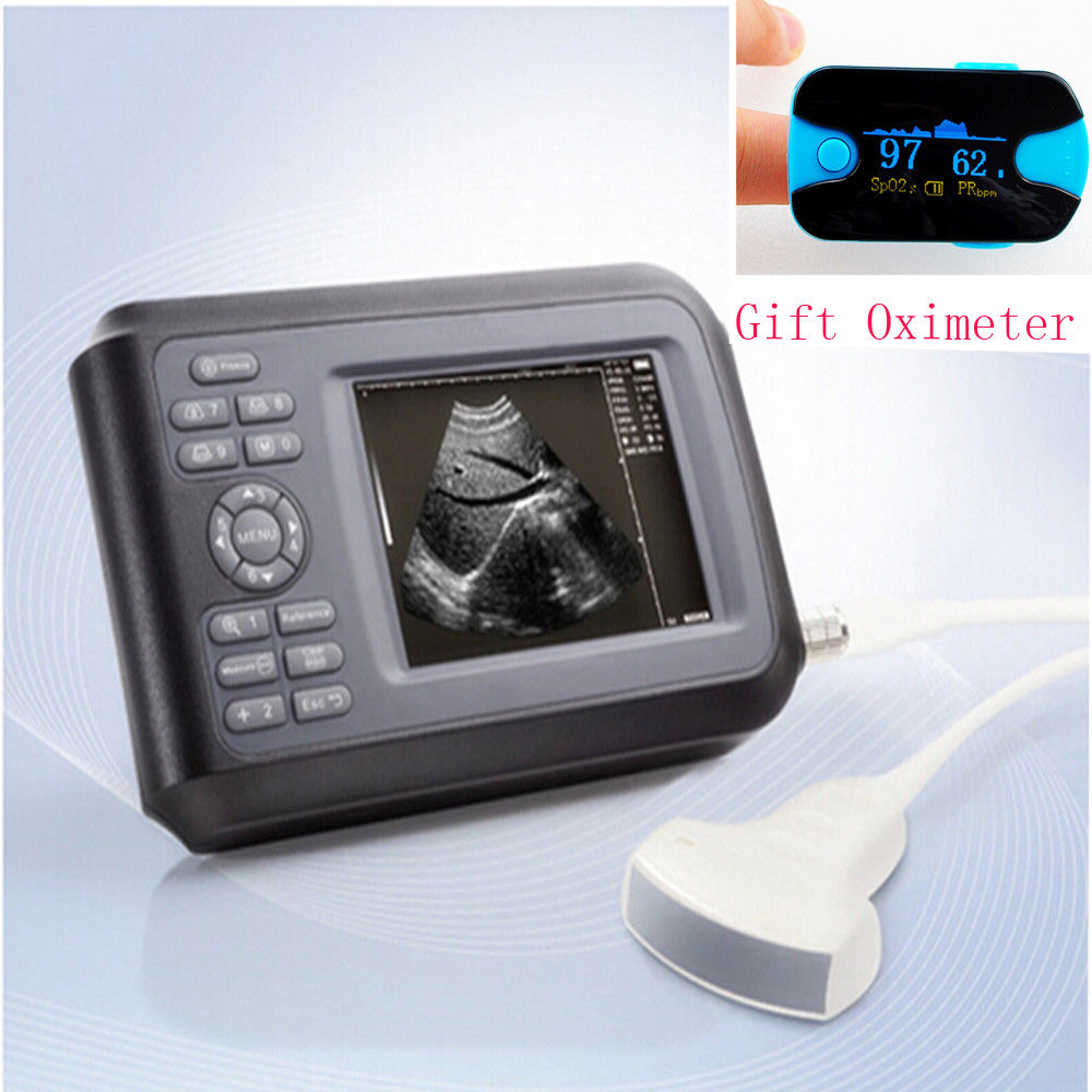 Medical Machine Ultrasound Scanner System 3.5M Convex probe Abdominal + Oximeter DIAGNOSTIC ULTRASOUND MACHINES FOR SALE