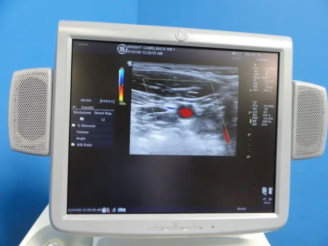 GE 7L Linear Array Ultrasound Transducer for Logiq & Vivid Series (10760) DIAGNOSTIC ULTRASOUND MACHINES FOR SALE