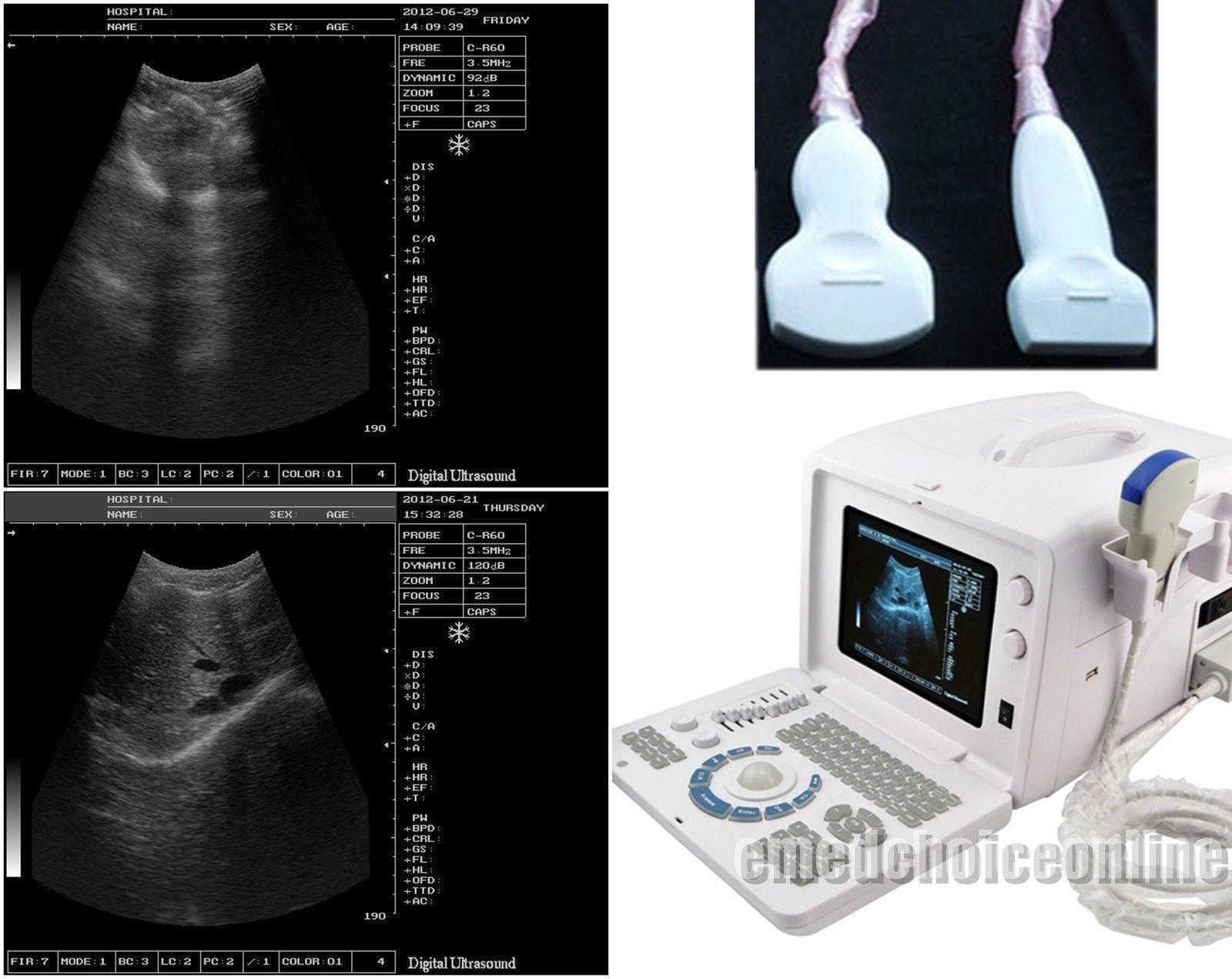 Digital Ultrasound machine Scanner Convex& linear Probe +3D Software CE Sale 190891211668 DIAGNOSTIC ULTRASOUND MACHINES FOR SALE