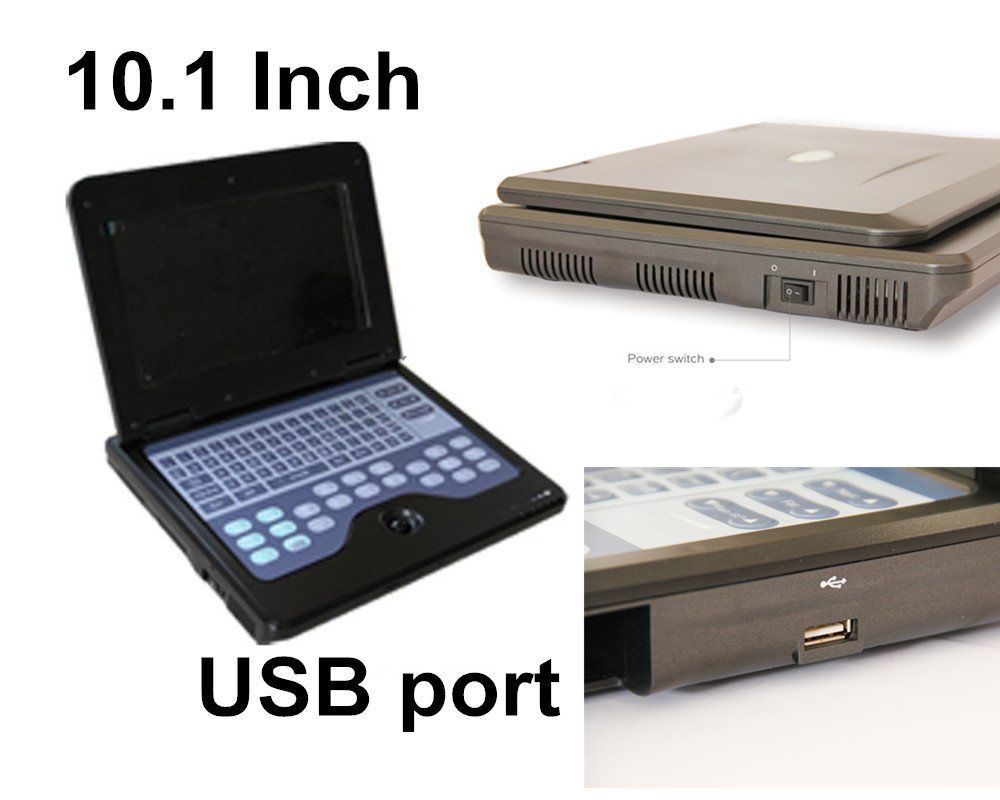 Digital Portable Laptop Ultrasound Scanner Machine 7.5M Linear Probe 600P2 CE 658126923446 DIAGNOSTIC ULTRASOUND MACHINES FOR SALE