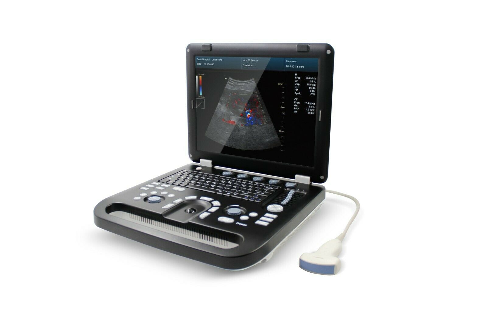 Color Doppler Ultrasound Scanner Portable Laptop Machine 3.5Mhz Convex Probe 6945040100362 DIAGNOSTIC ULTRASOUND MACHINES FOR SALE