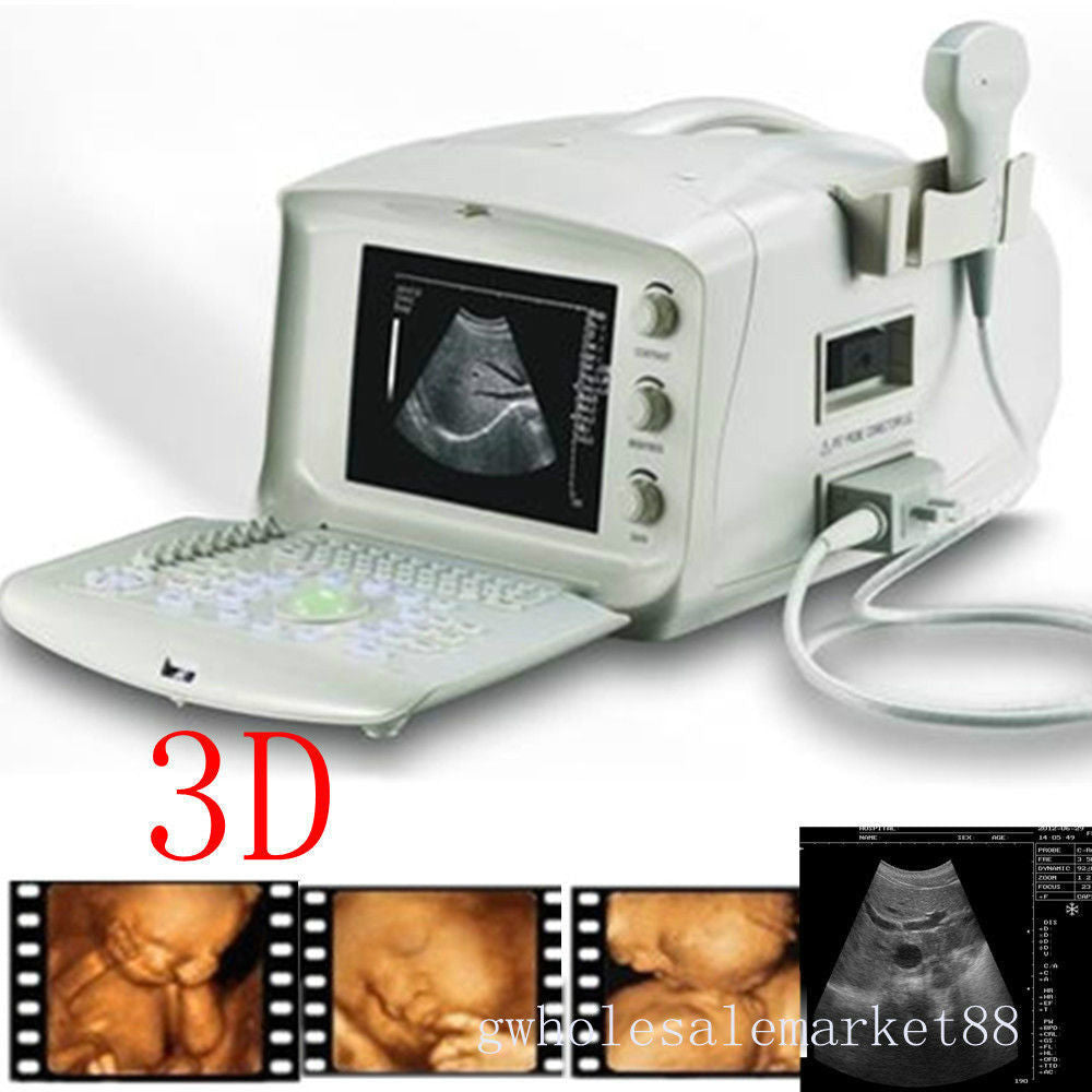 Professional Portable Digital Ultrasound Scanner Transvaginal Probe +3D Software 190891732514 DIAGNOSTIC ULTRASOUND MACHINES FOR SALE