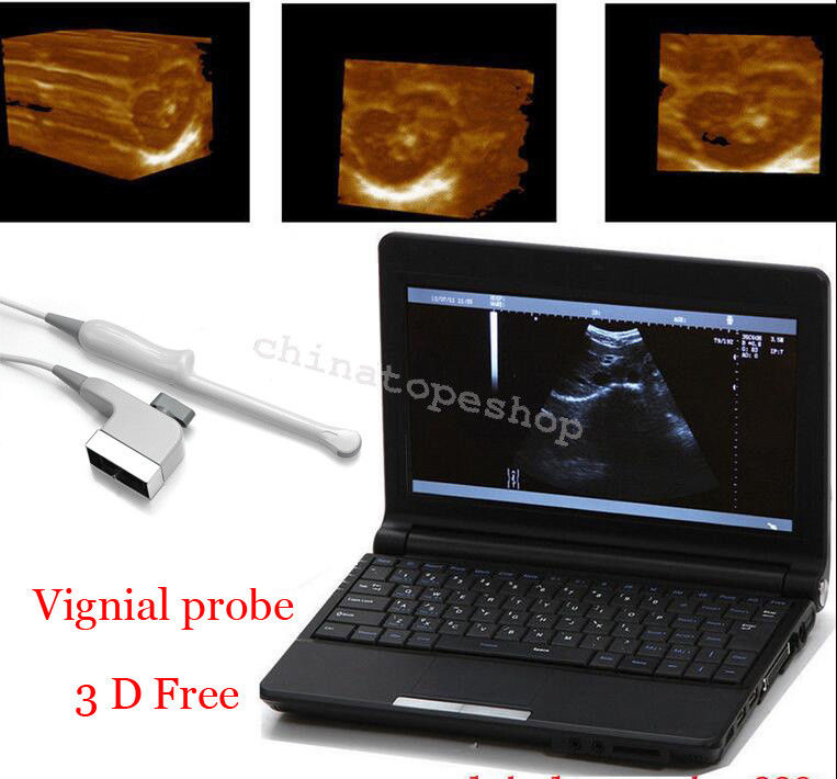 Laptop Machine Ultrasound scanner Transvaginal probe 3D Worksation + Case 190891297143 DIAGNOSTIC ULTRASOUND MACHINES FOR SALE