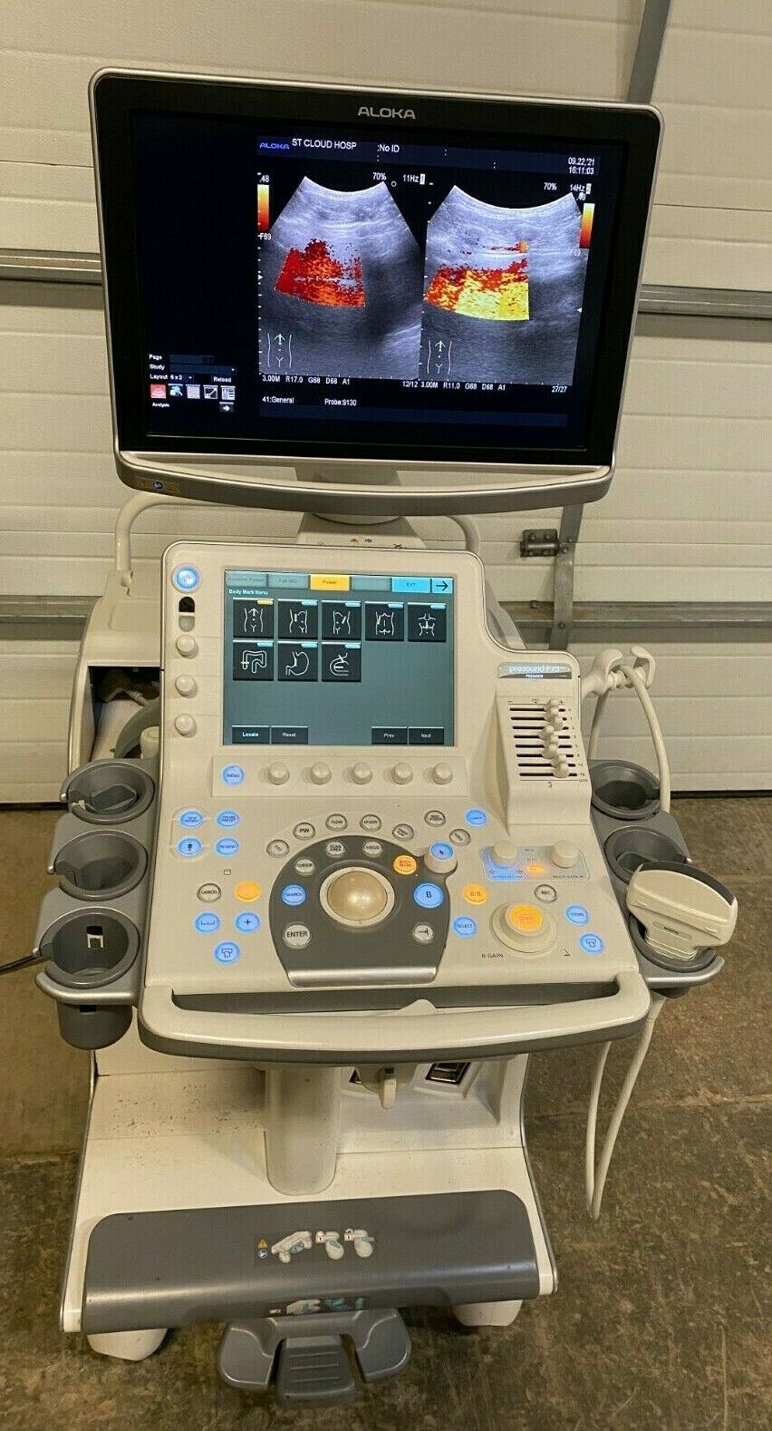 ALOKA Hitachi Prosound F75 Ultrasound UST-9130 Probe "Year 2014 BIOMED TESTED" DIAGNOSTIC ULTRASOUND MACHINES FOR SALE