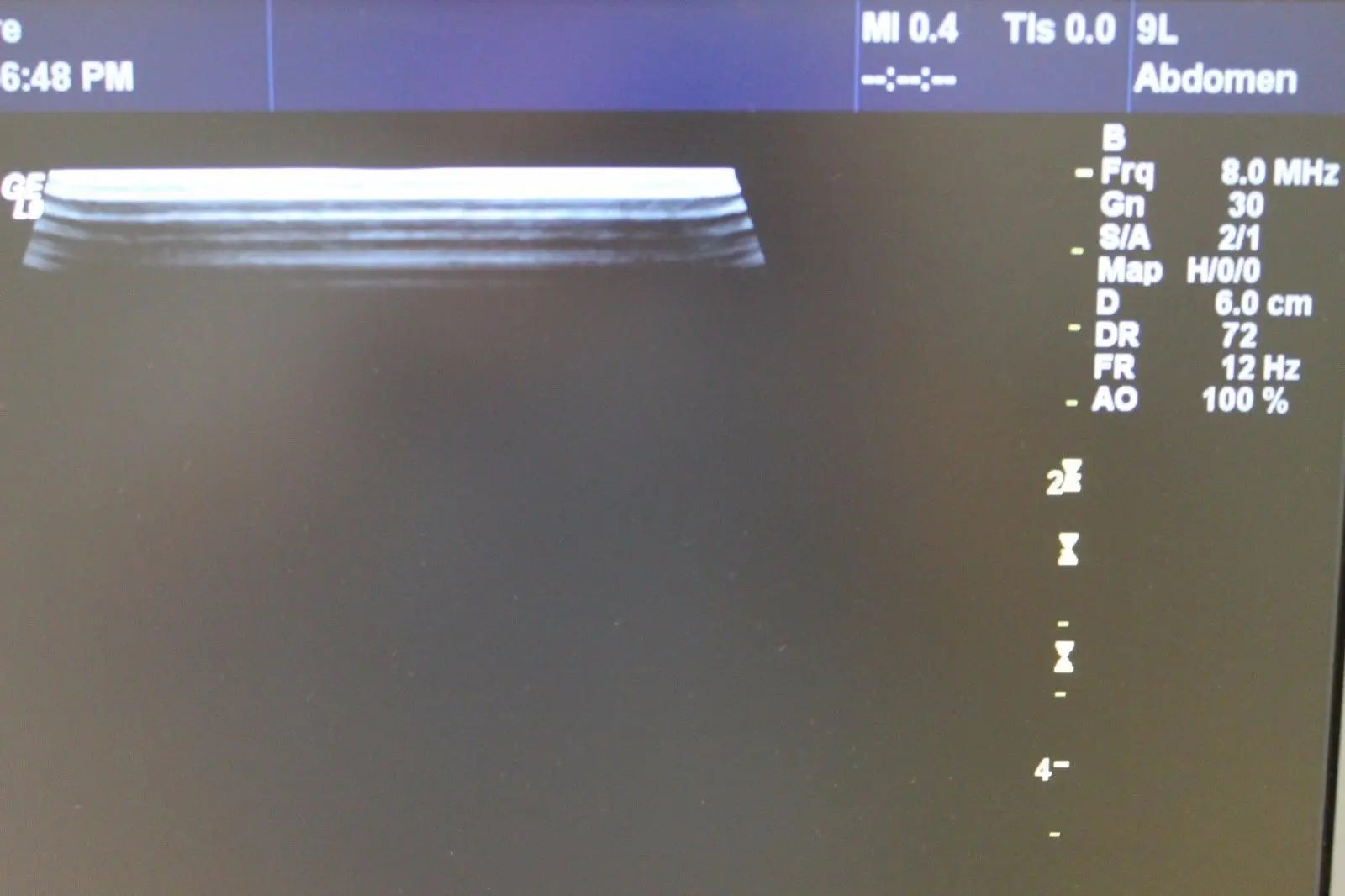 GE 9L Ultrasound Probe DIAGNOSTIC ULTRASOUND MACHINES FOR SALE