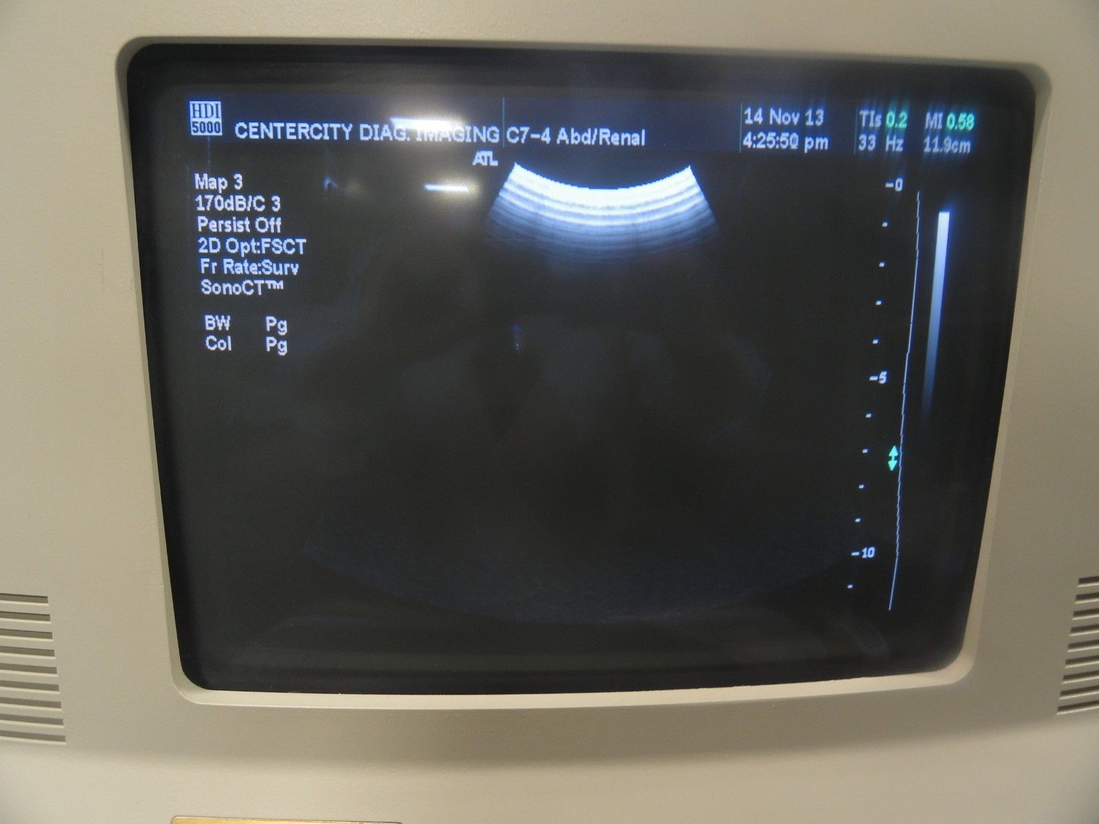 2009 Philips C7-4 40R Curved Array Convex Probe for ATL HDI Series (5963 ) DIAGNOSTIC ULTRASOUND MACHINES FOR SALE