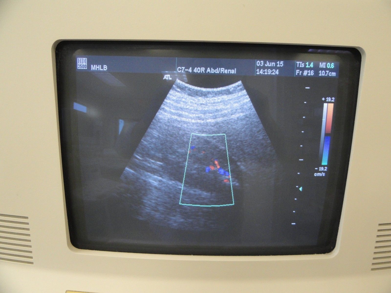 ATL C7-4 40R Curved Array Convex Abdominal Probe for ATL HDI Series (8938 ) DIAGNOSTIC ULTRASOUND MACHINES FOR SALE