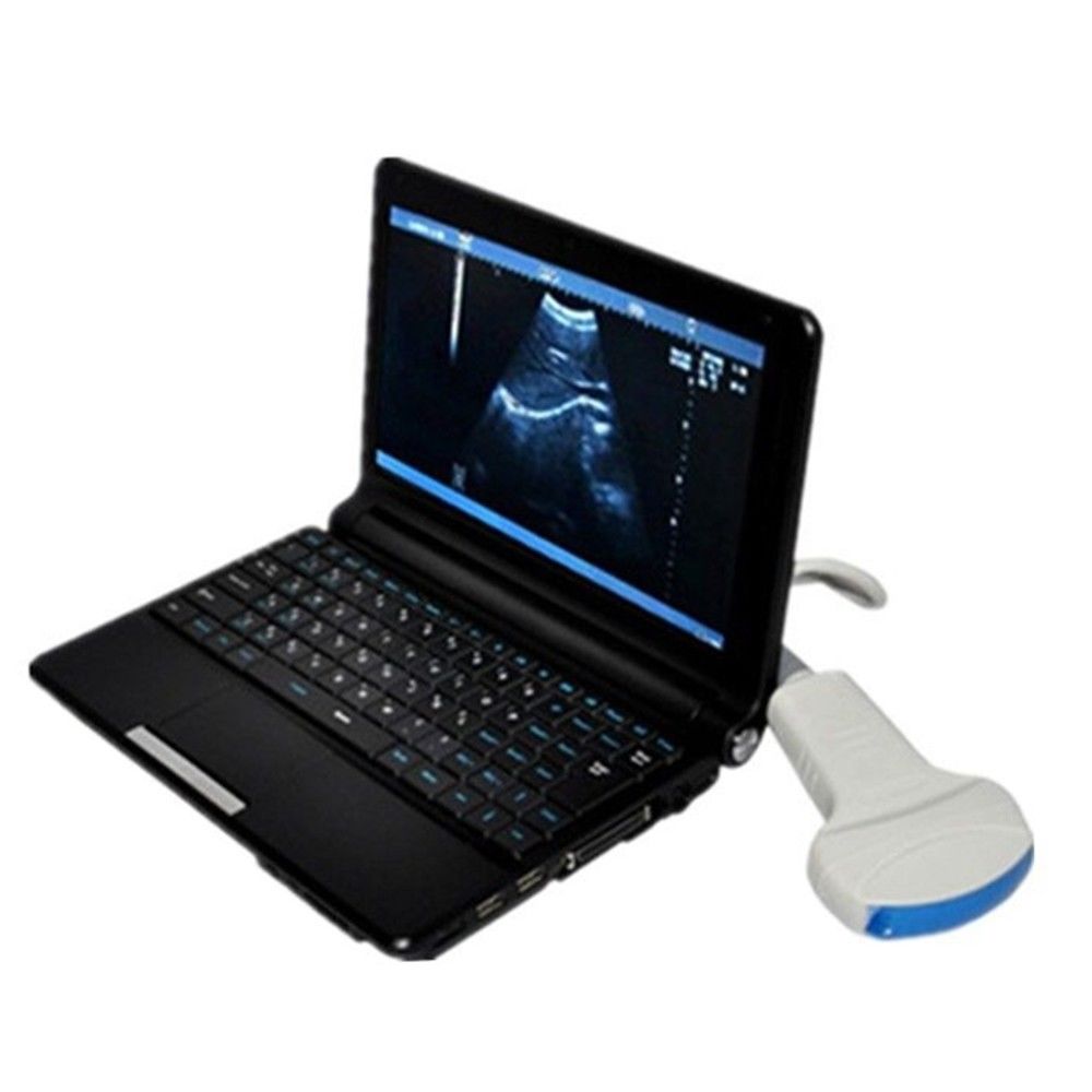 New +3D Software Laptop Ultrasound Machine Scanner system + Linear Probe 7.5MHZ DIAGNOSTIC ULTRASOUND MACHINES FOR SALE