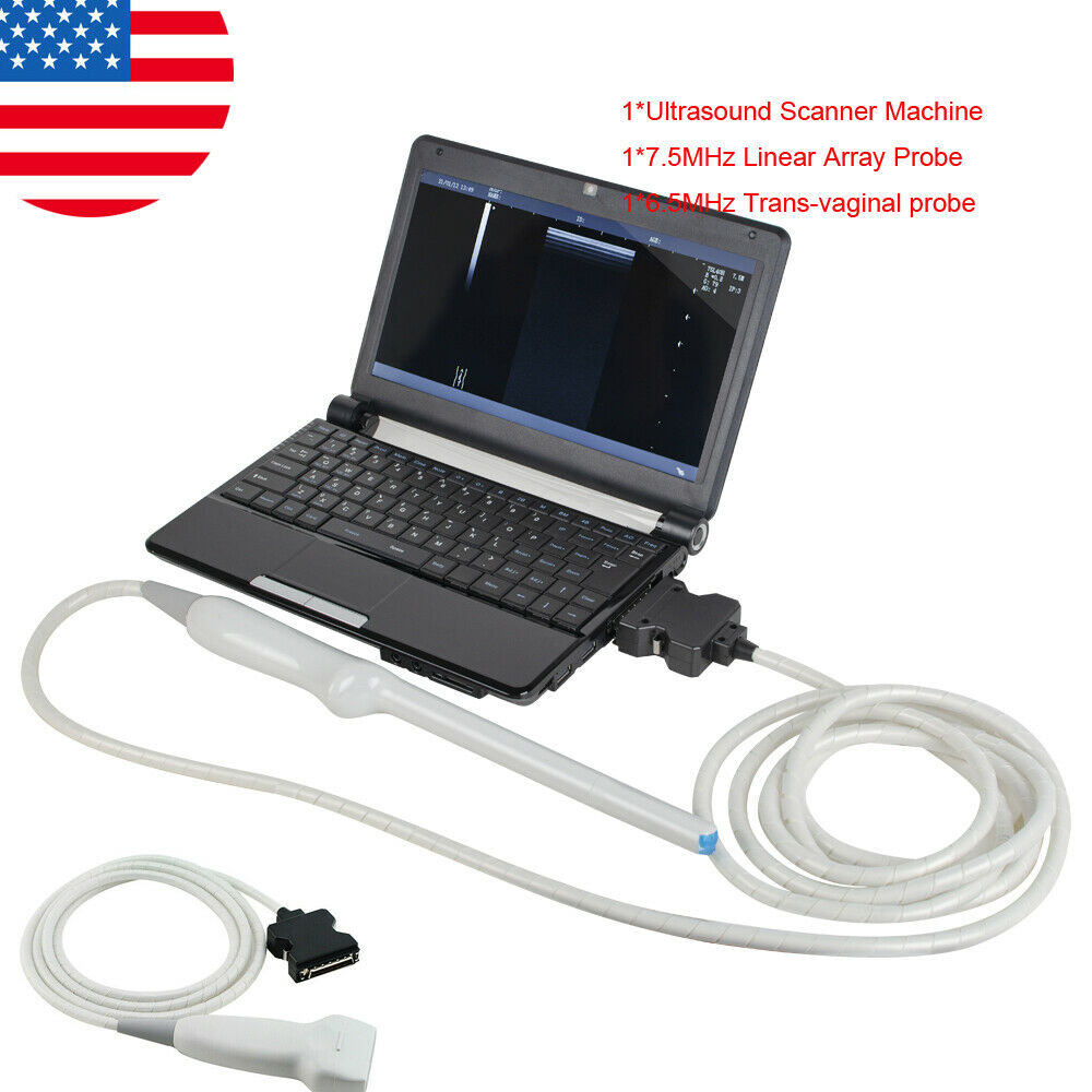 Digital Laptop Machine Ultrasound Scanner 7.5MHz Linear &Trans-vaginal Probe DIAGNOSTIC ULTRASOUND MACHINES FOR SALE