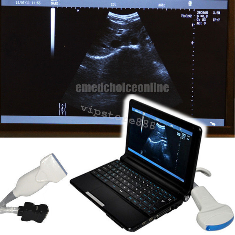 Hospital Digital Laptop Ultrasound Scanner Linear 9000F +Free 3D Linear probe CE DIAGNOSTIC ULTRASOUND MACHINES FOR SALE
