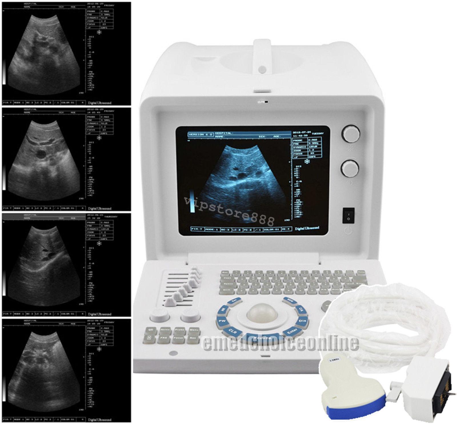 Digital Portable Ultrasound Scanner Machine + Convex & Transvaginal 2 Probes DHL 190891270993 DIAGNOSTIC ULTRASOUND MACHINES FOR SALE