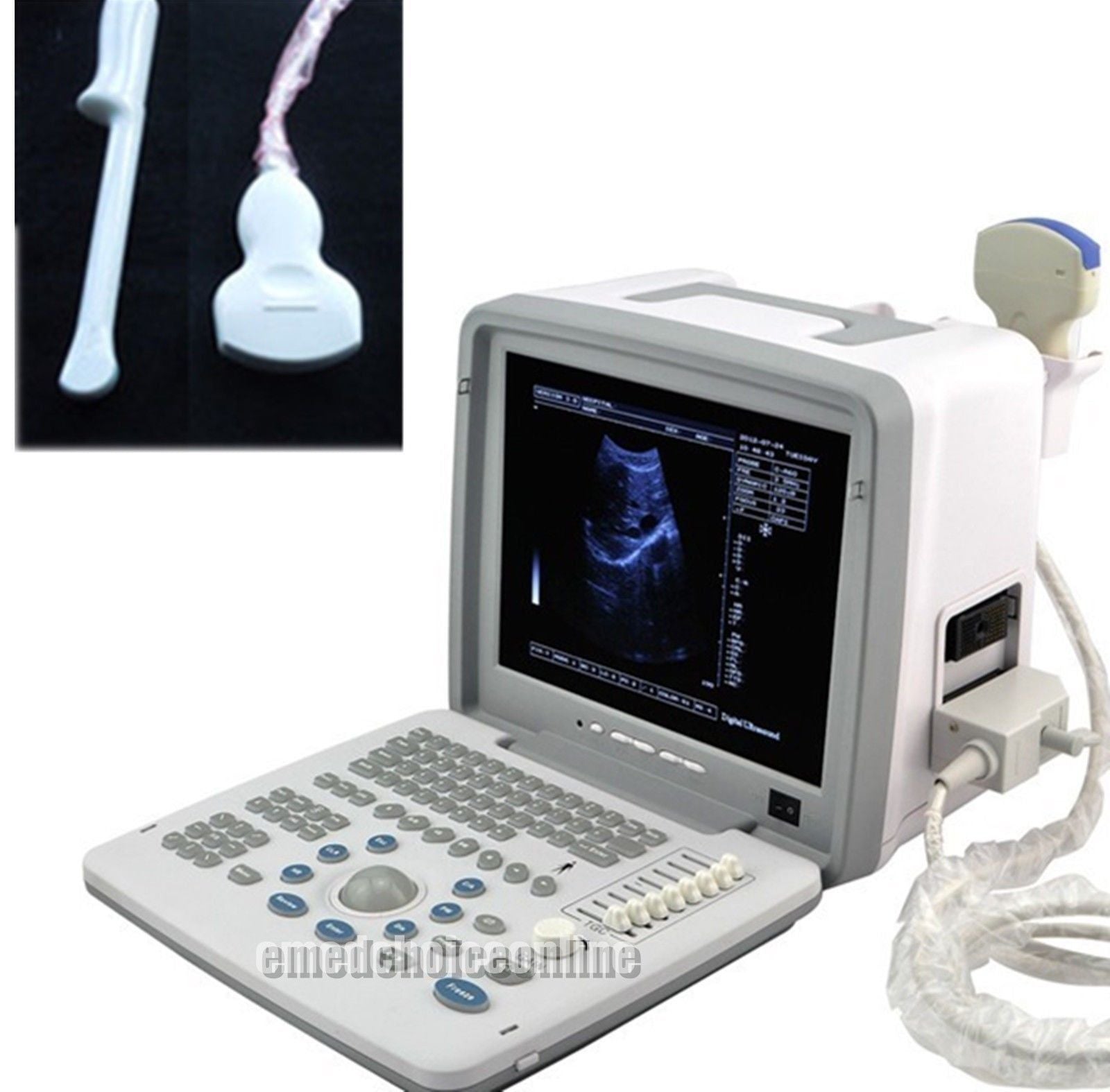 Large LED Digital 3D Ultrasound Scanner Machine +Convex &Transvaginal 2 Probes 190891662194 DIAGNOSTIC ULTRASOUND MACHINES FOR SALE
