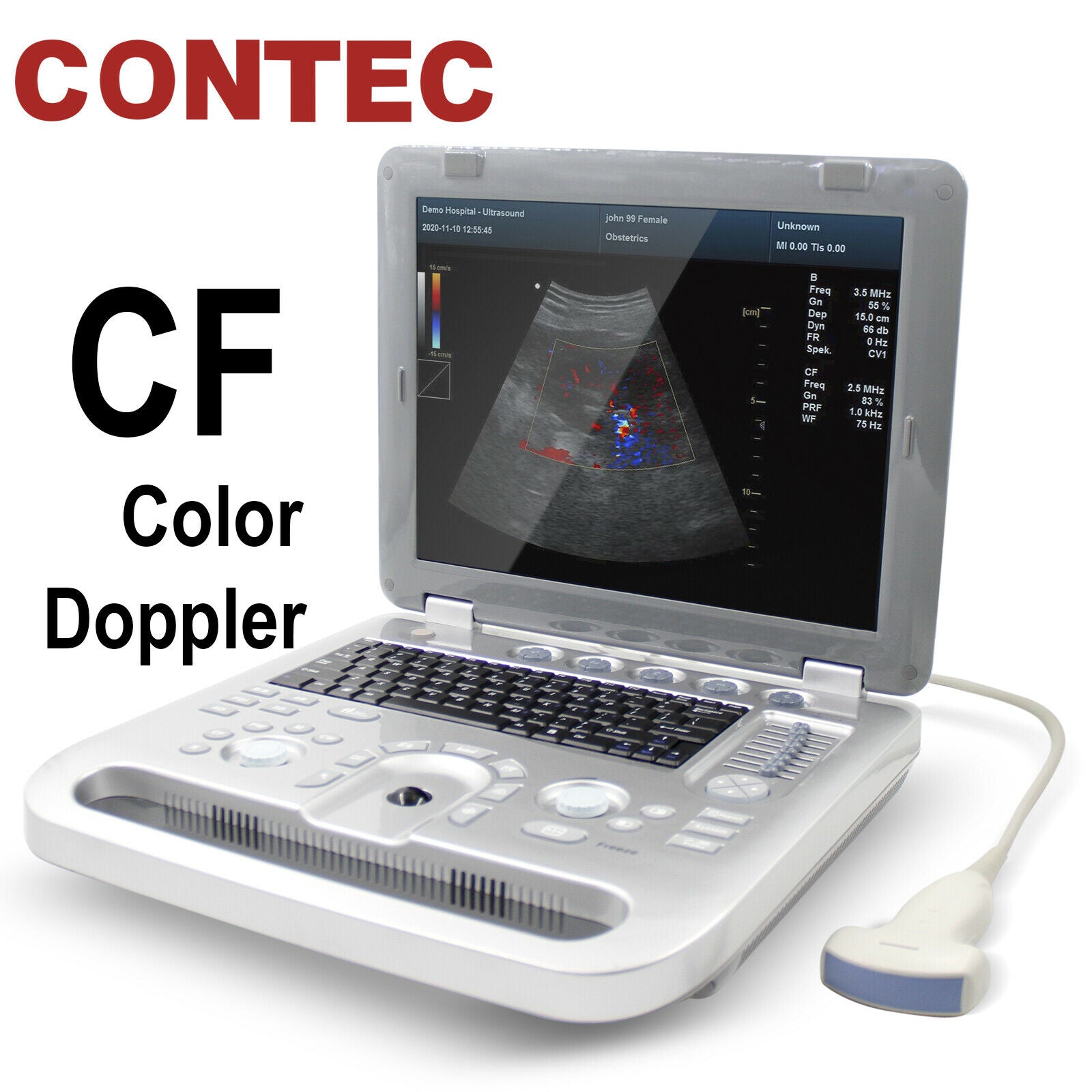 Portable High Resolution Color Doppler Ultrasound Scanner with Convex Probe New 6945040100362 DIAGNOSTIC ULTRASOUND MACHINES FOR SALE