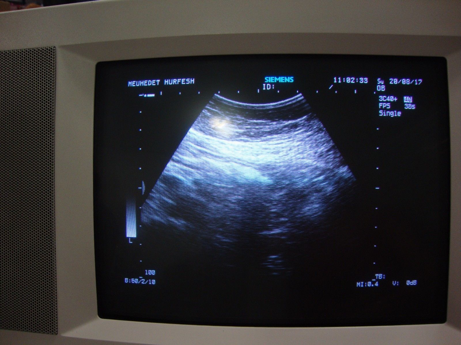 siemens sienna diagnostic ultrasound system GM-6601A2E00 2002 DIAGNOSTIC ULTRASOUND MACHINES FOR SALE