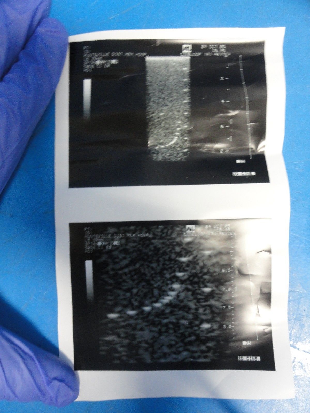 ATL L5 38MM (5.0LA) P/N 4000-0259-02D Linear Array Probe for UM9 HDI (8927) DIAGNOSTIC ULTRASOUND MACHINES FOR SALE