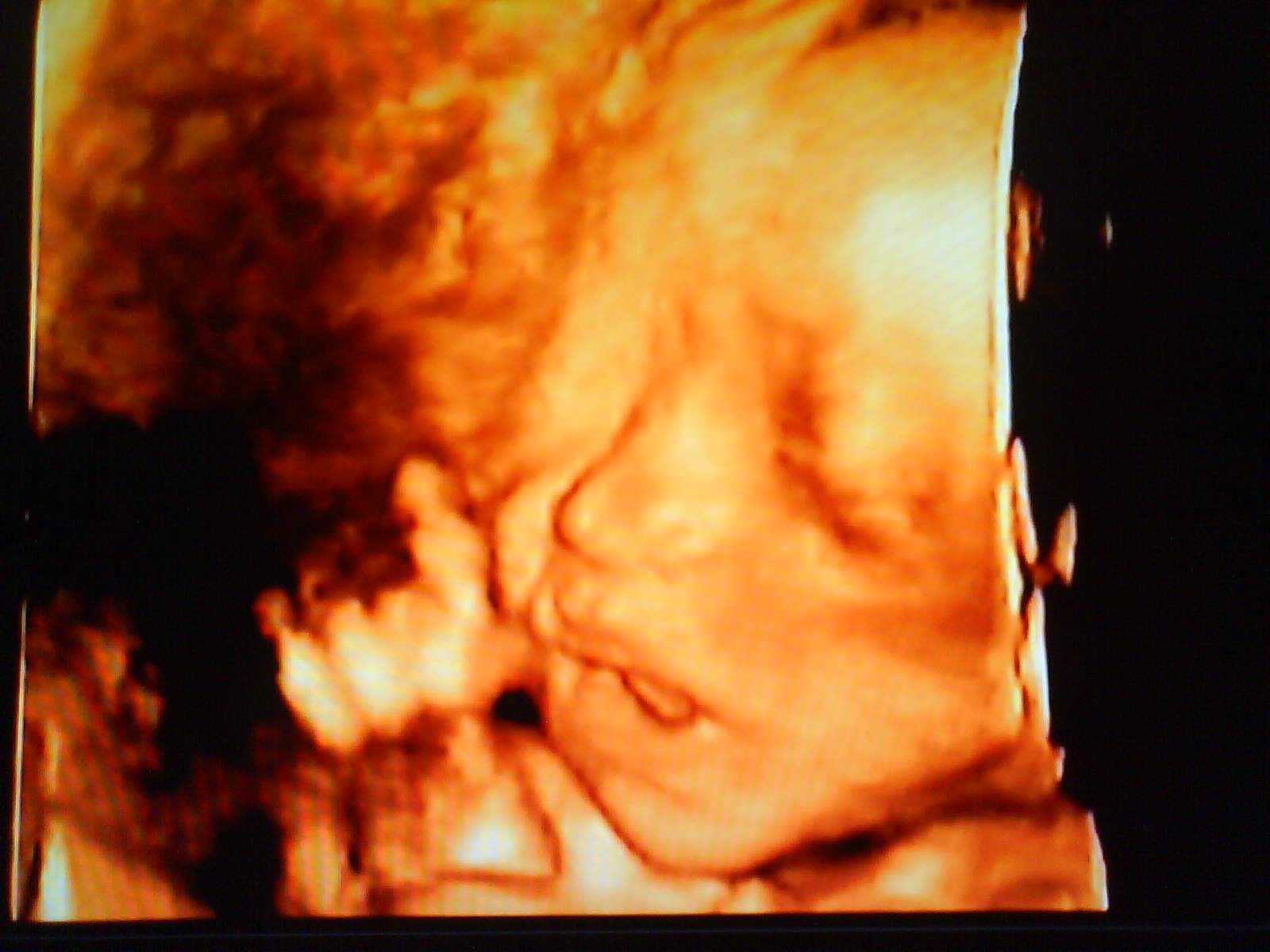 15" Color Ultrasound Scanner Machine Convex Transvaginal 2 Probes Top Quanlity 190891911995 DIAGNOSTIC ULTRASOUND MACHINES FOR SALE