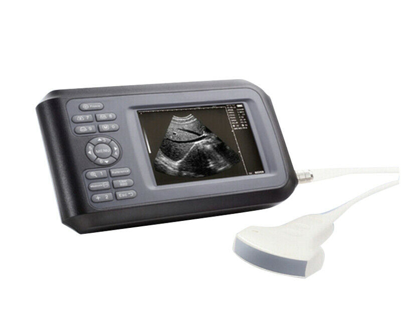 Handheld Ultrasound Scanner/Machine Convex Probe Abdominal Ultrasound Human Use DIAGNOSTIC ULTRASOUND MACHINES FOR SALE