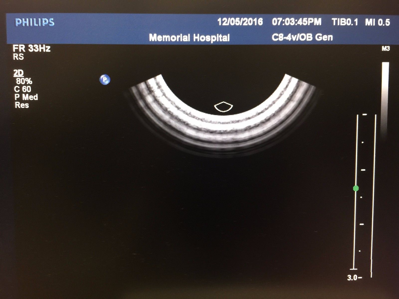 Philips C8-4v Endovaginal Ultrasound Transducer for Philips iU22 Systems DIAGNOSTIC ULTRASOUND MACHINES FOR SALE