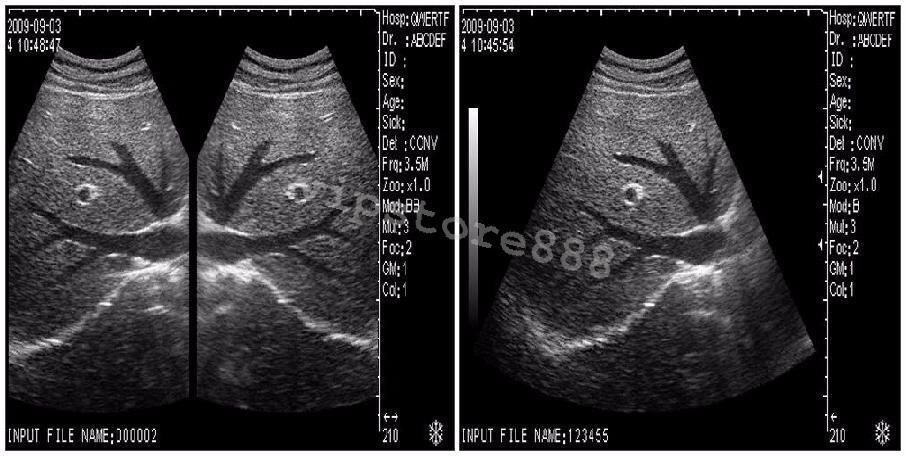 Digital Ultrasound Scanner Machine +Convex +Vaginal + Linear 3 Probes/Sensor+3D DIAGNOSTIC ULTRASOUND MACHINES FOR SALE