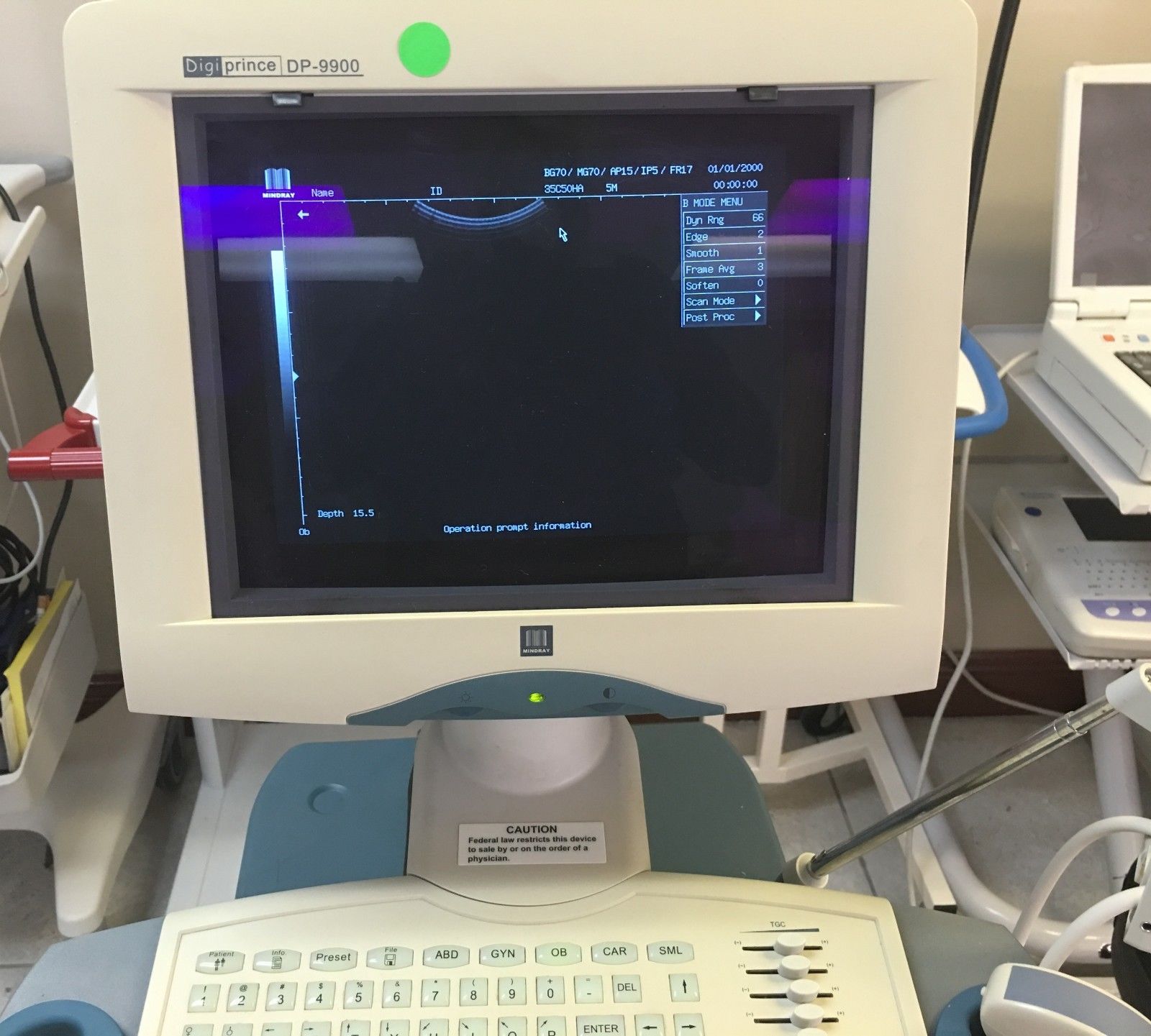 MINDRAY-ULTRASOUND-DP-9900 OBGYN System DIAGNOSTIC ULTRASOUND MACHINES FOR SALE