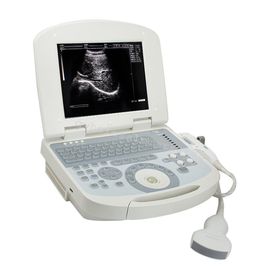 Portable Ultrasound Machine Scanner System Convex probe 3D Software Best Image 190891045898 DIAGNOSTIC ULTRASOUND MACHINES FOR SALE