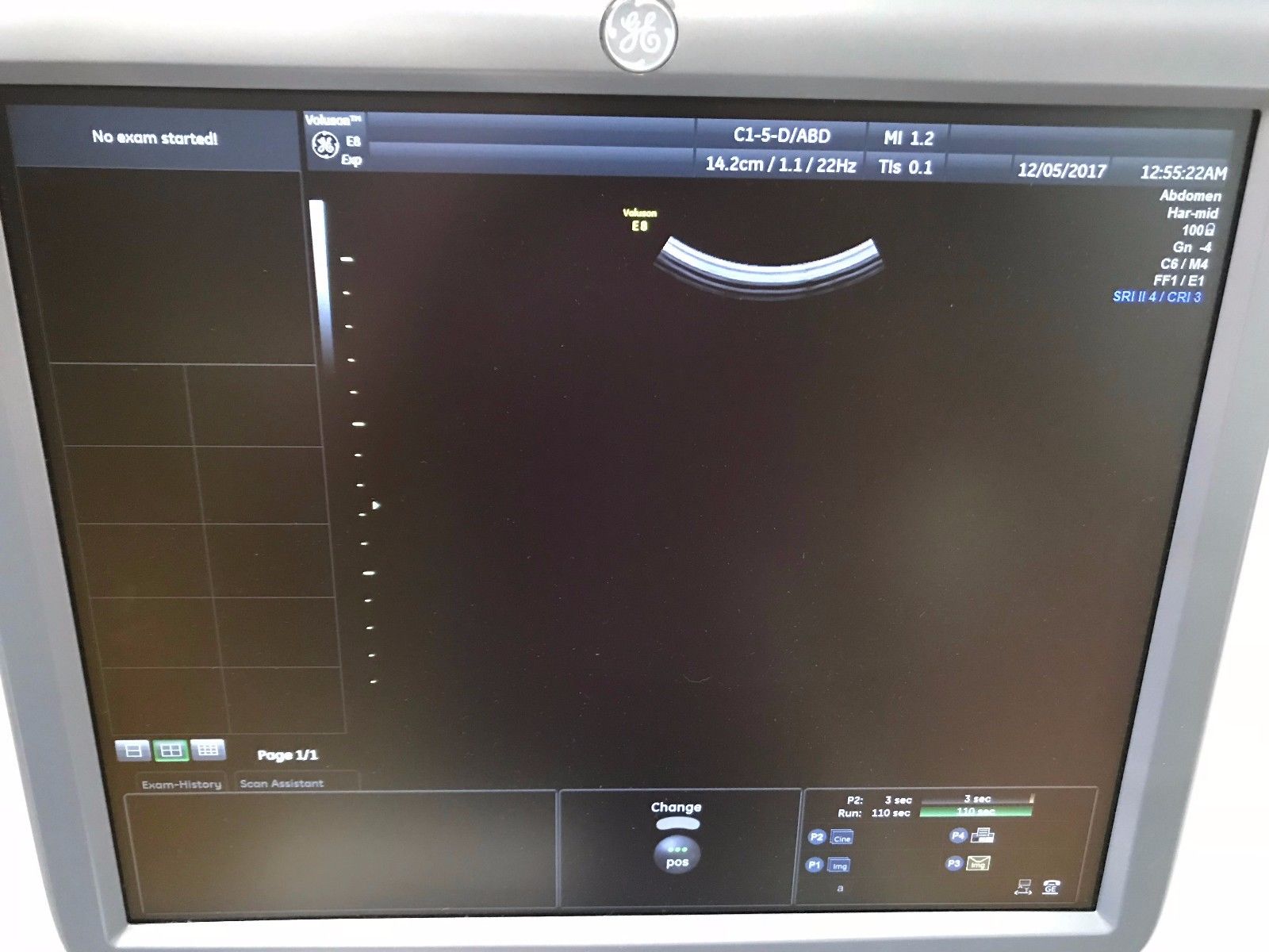 GE VOLUSON E8 BT13 HD LIVE ULTRASOUND WITH RM6C, C1-5D, IC5-9D PROBES DIAGNOSTIC ULTRASOUND MACHINES FOR SALE