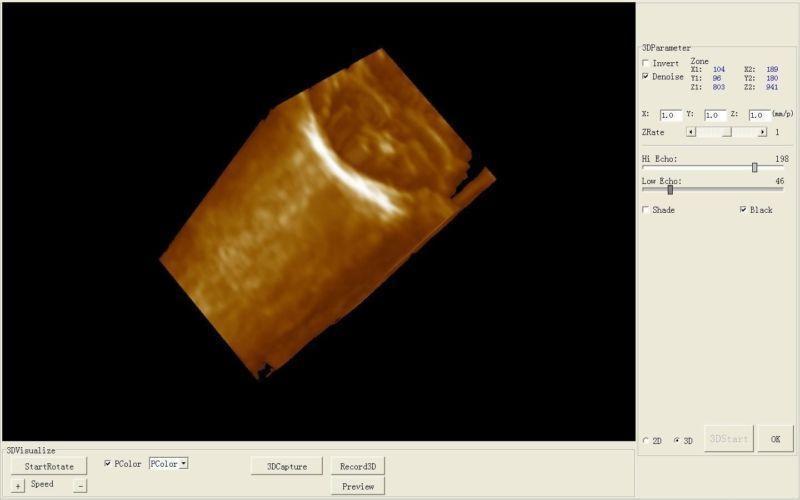 10'' Portable Ultrasound Scanner Machine Convex Viginal Probe 3 D Ultrasound AA 190891478306 DIAGNOSTIC ULTRASOUND MACHINES FOR SALE