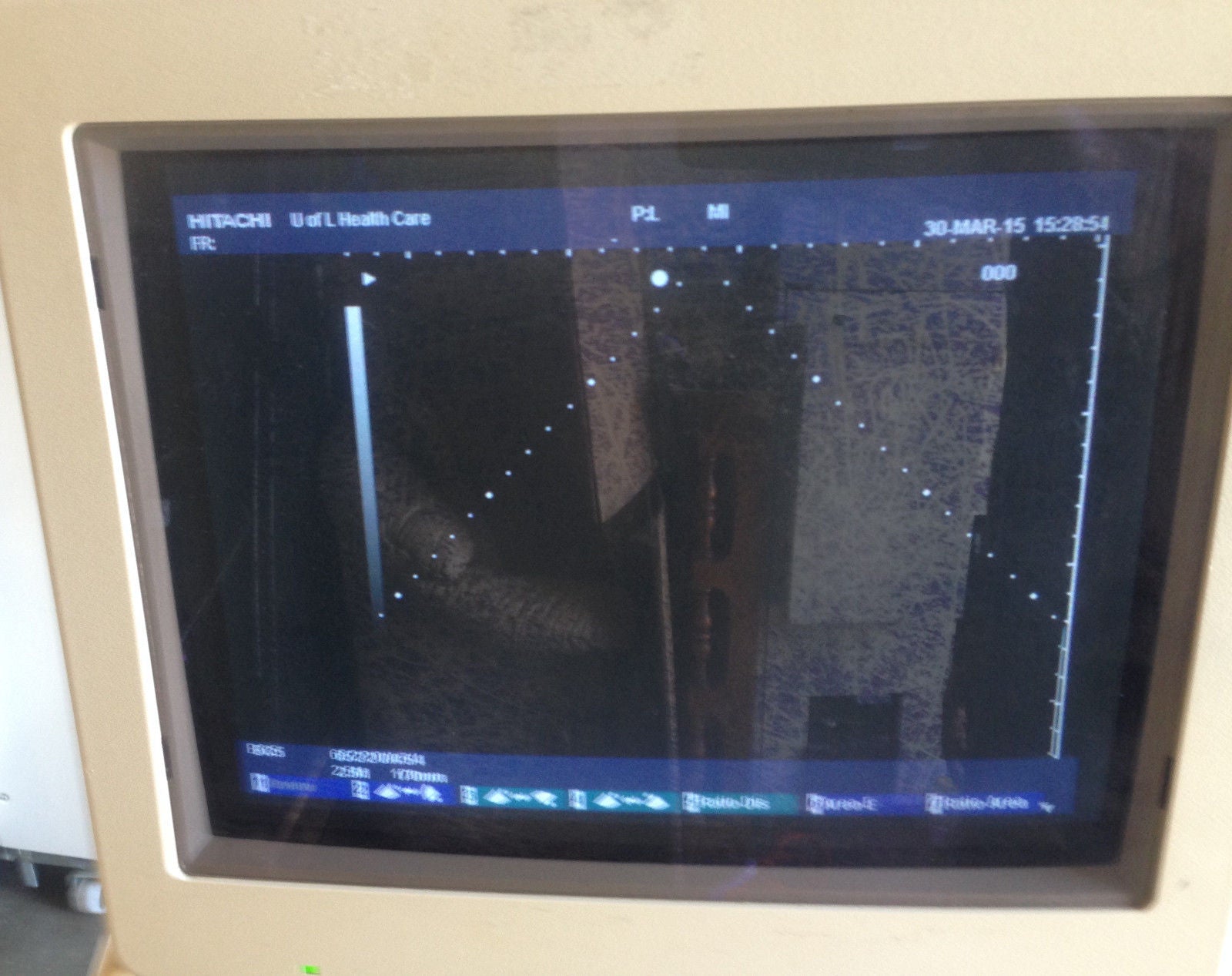 Hitachi EUB-6000 Ultrasound Machine Scanner with Foot Pedal and Recorder DIAGNOSTIC ULTRASOUND MACHINES FOR SALE