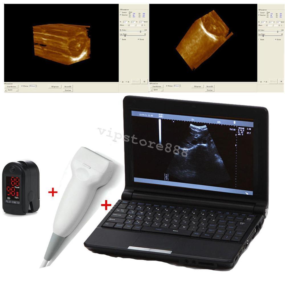 Full Digital Laptop Ultrasound Scanner Linear 9000F + Free 3D Linear probe New DIAGNOSTIC ULTRASOUND MACHINES FOR SALE