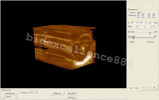 Ultrasound Scanner Machine Unit 3.5Mhz Convex Transvaginal Probe Free 3D CE DIAGNOSTIC ULTRASOUND MACHINES FOR SALE