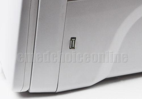 Digital Ultrasound Scanner Machine Linear Probe/Transducer 3D Scan Oximeter DIAGNOSTIC ULTRASOUND MACHINES FOR SALE