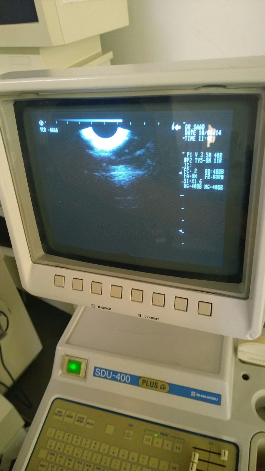 Shimadzu SDU-400 XP 2003 Ultrasound DIAGNOSTIC ULTRASOUND MACHINES FOR SALE