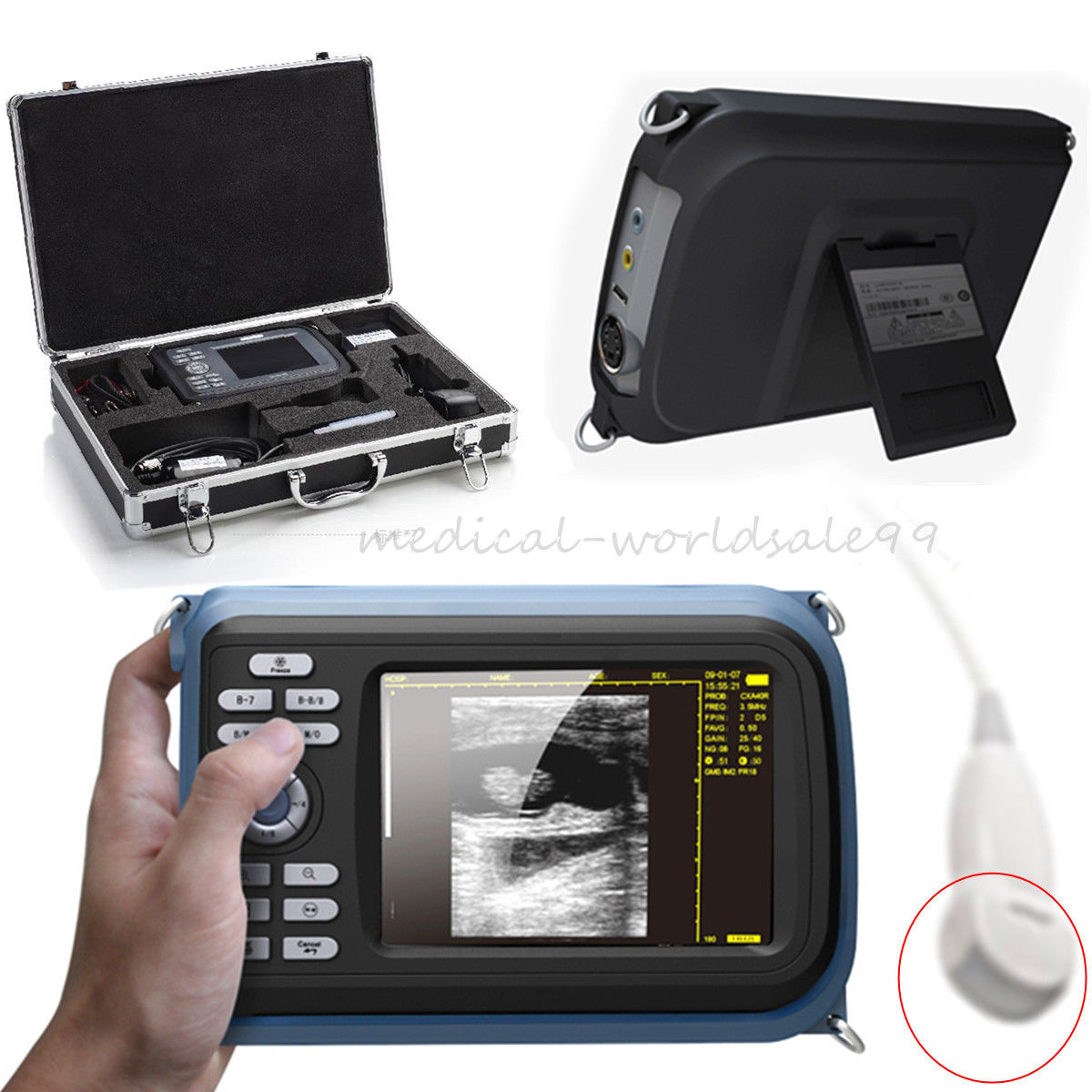 VET Handheld Ultrasound Scanner Machine + Micro-Convex Probe/Sensor Animal CE 190891523389 DIAGNOSTIC ULTRASOUND MACHINES FOR SALE