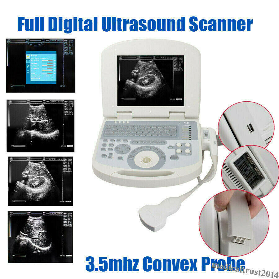 Portable Human Digital Laptop Ultrasound Scanner Machine System Convex Probe 3D DIAGNOSTIC ULTRASOUND MACHINES FOR SALE