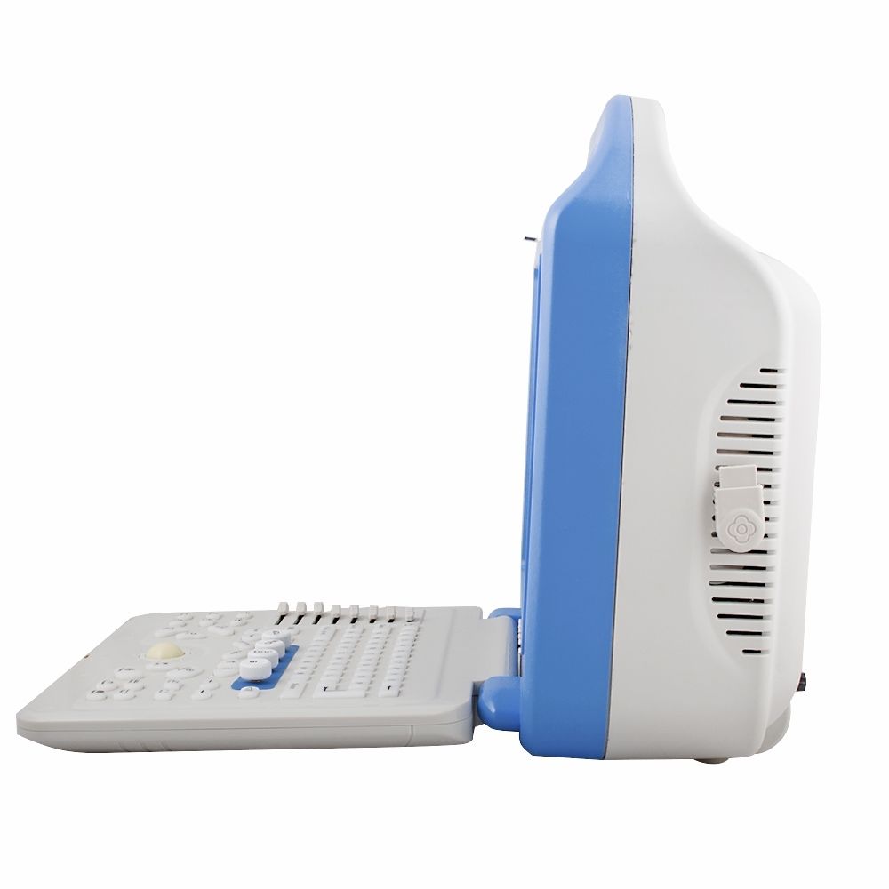 Full Digital Color Doppler Ultrasound Scanner Convex + Linear 2 Sensors/Probe A+ 190891277251 DIAGNOSTIC ULTRASOUND MACHINES FOR SALE