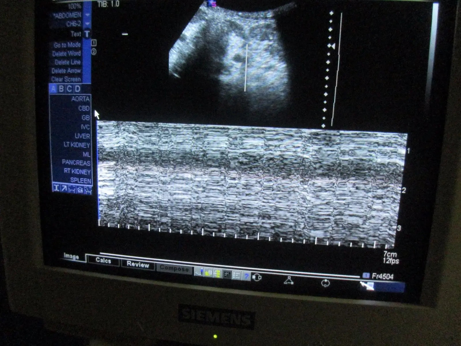 Siemens Sonoline Antares ver 3.5 Ultrasound TESTED by Certified Ultrasound Tech DIAGNOSTIC ULTRASOUND MACHINES FOR SALE