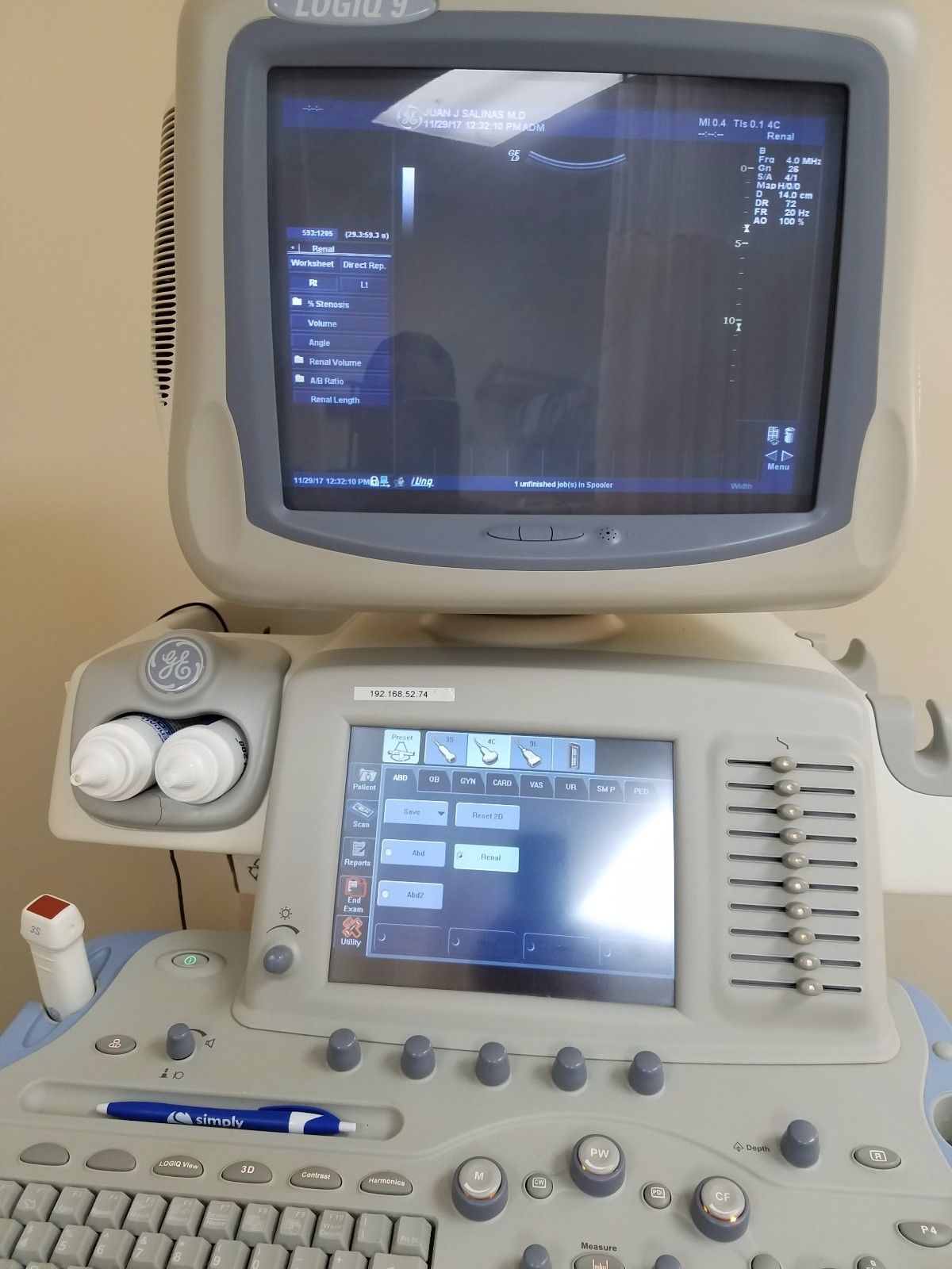 ultrasound GE Logiq 9 share services. DIAGNOSTIC ULTRASOUND MACHINES FOR SALE