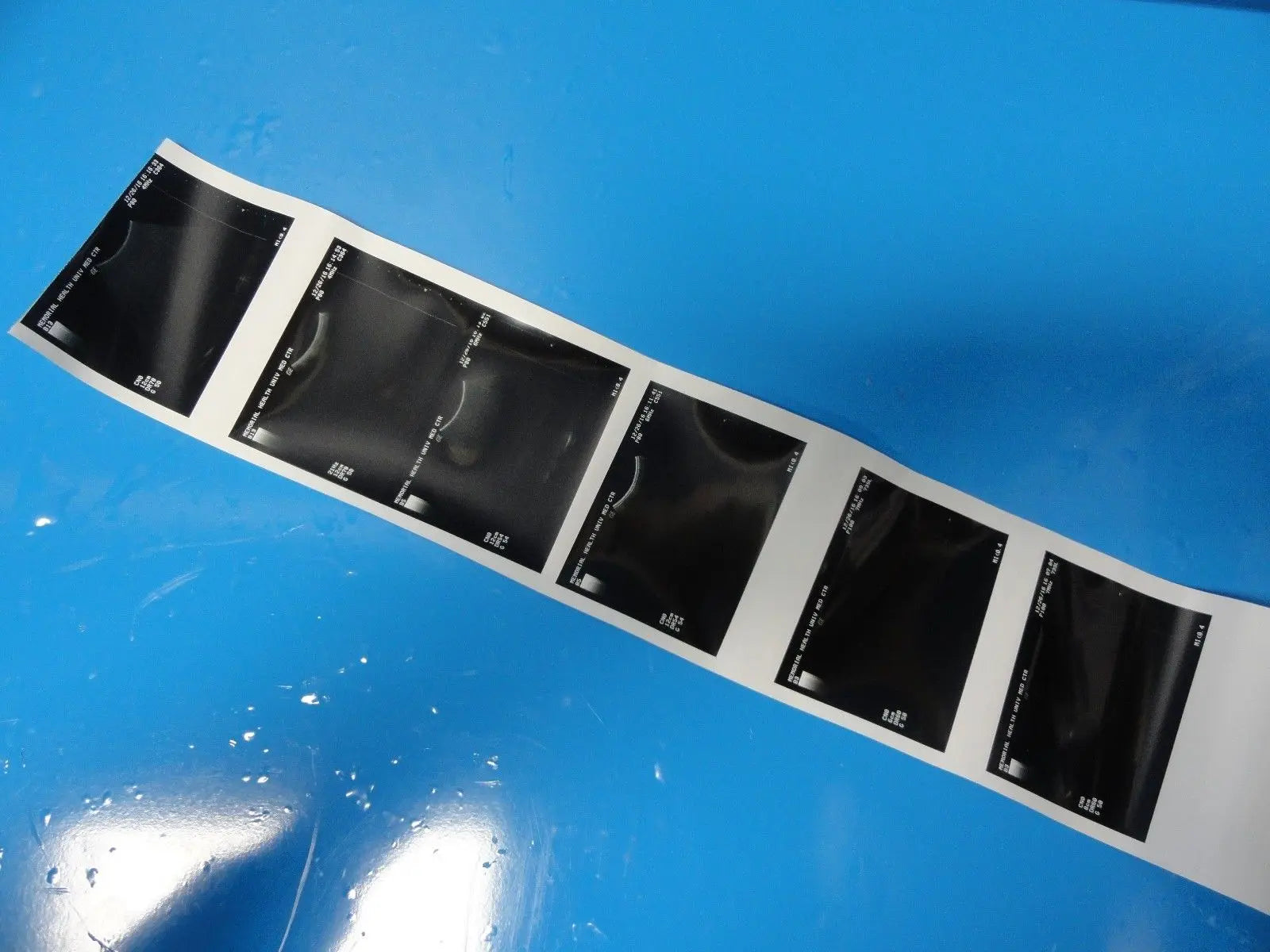 GE Logiq 400 MD Soft Pack Ultrasound W/ C364, C551, 739L Probes & Printer~12413 DIAGNOSTIC ULTRASOUND MACHINES FOR SALE